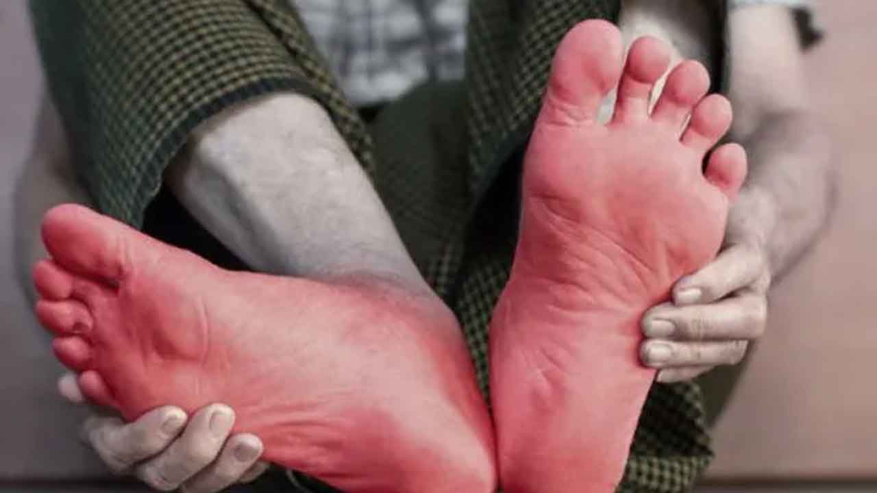Pain In The Ankle