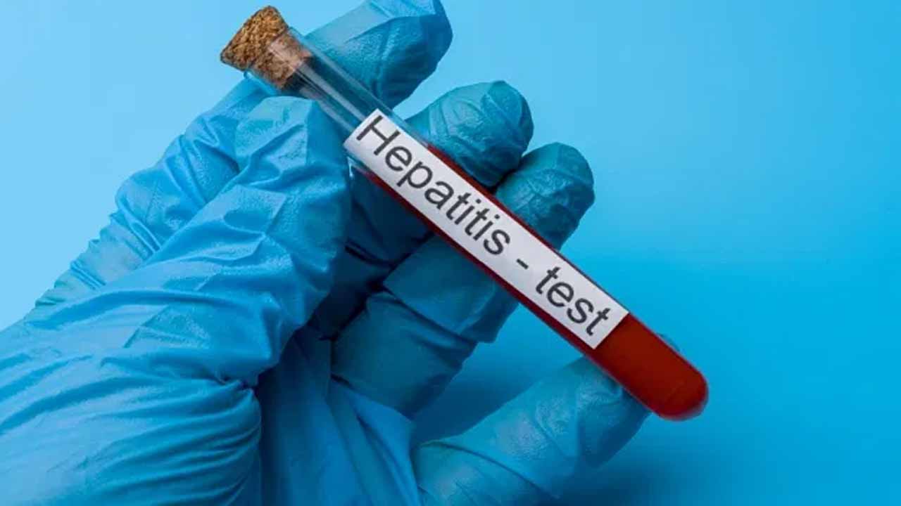 Why does hepatitis occur? Let's find out what to do to prevent it.