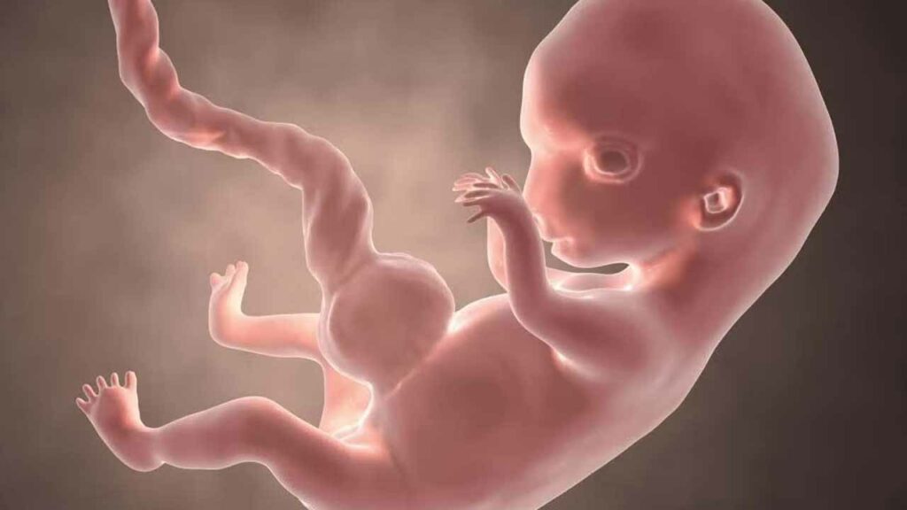 Abortion