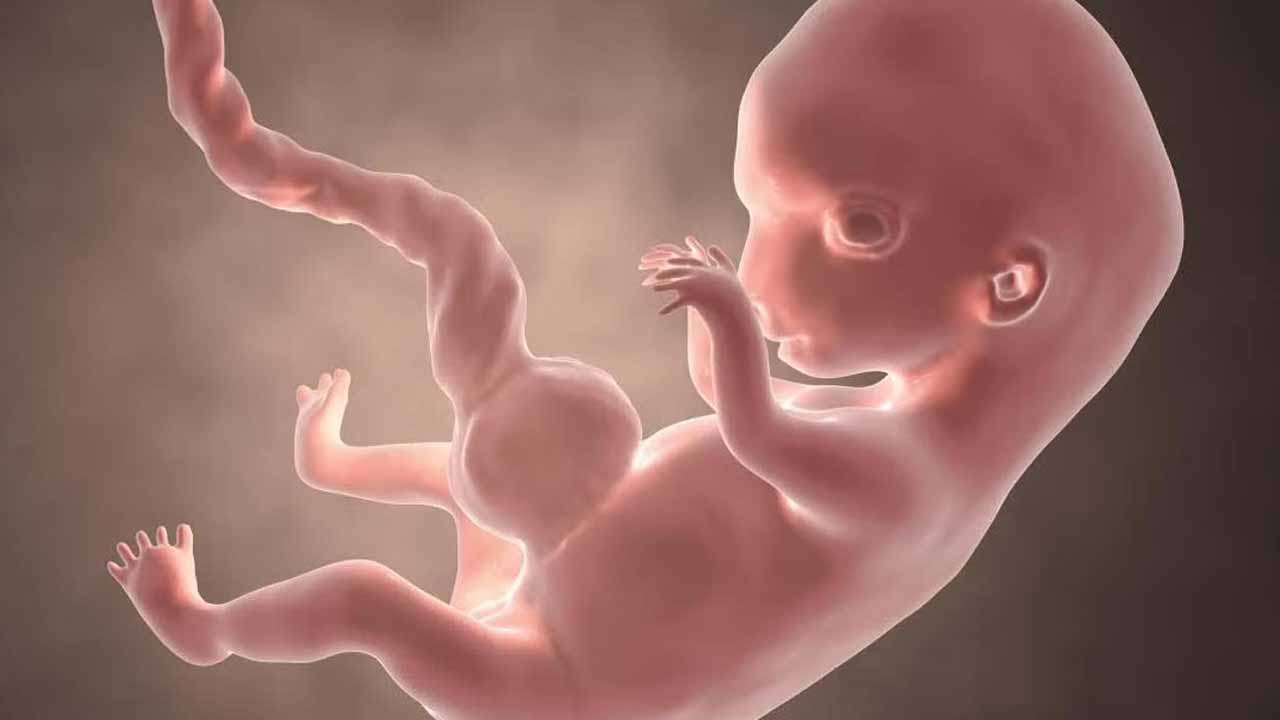 Abortion