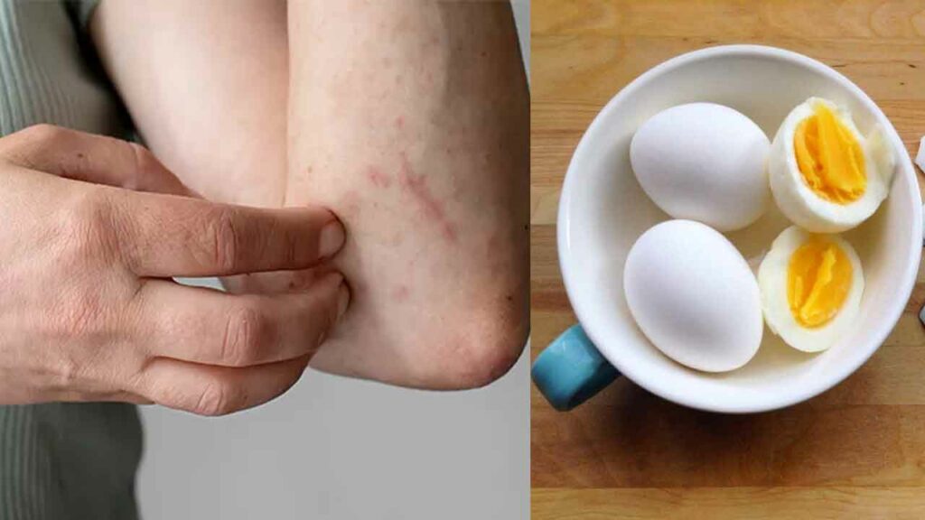 Boiled Egg
