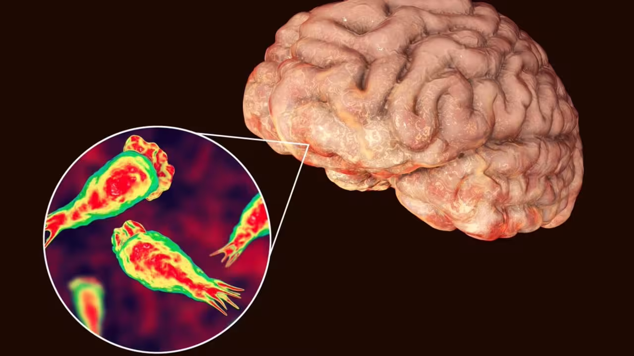 Brain Eating Amoeba