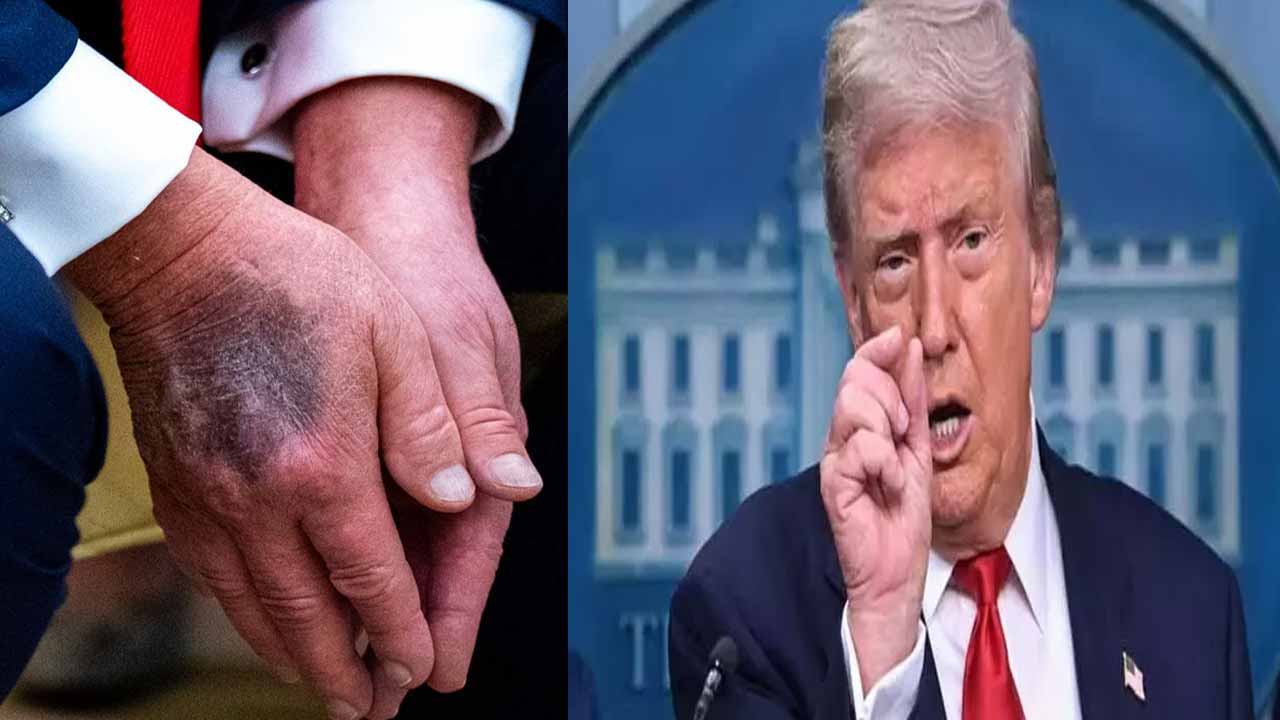 Speculations about Trump's health... Response with a Truth post