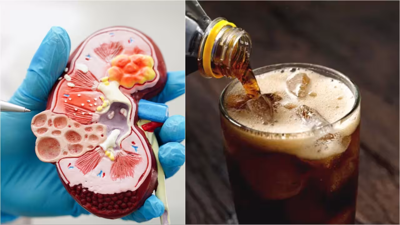 Damage Kidney: వామ్మో.. మనం తరచుగా తీసుకునే ఈ ఫుడ్స్ కిడ్నీలను దెబ్బతీస్తాయా.. చాలా డేంజర్! Damage Kidney