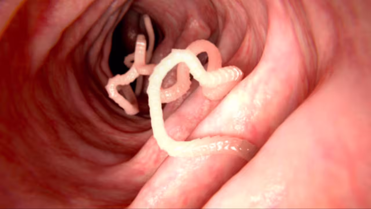 Intestinal Worms: కడుపులో నులిపురుగుల సమస్యతో బాధపడుతున్నారా.. అయితే ఈ చిట్కాలు పాటించాల్సిందే! Intestinal Worms
