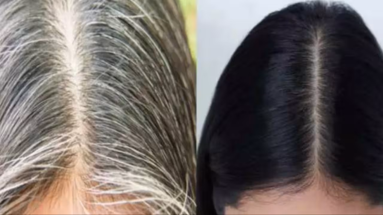 White Hair