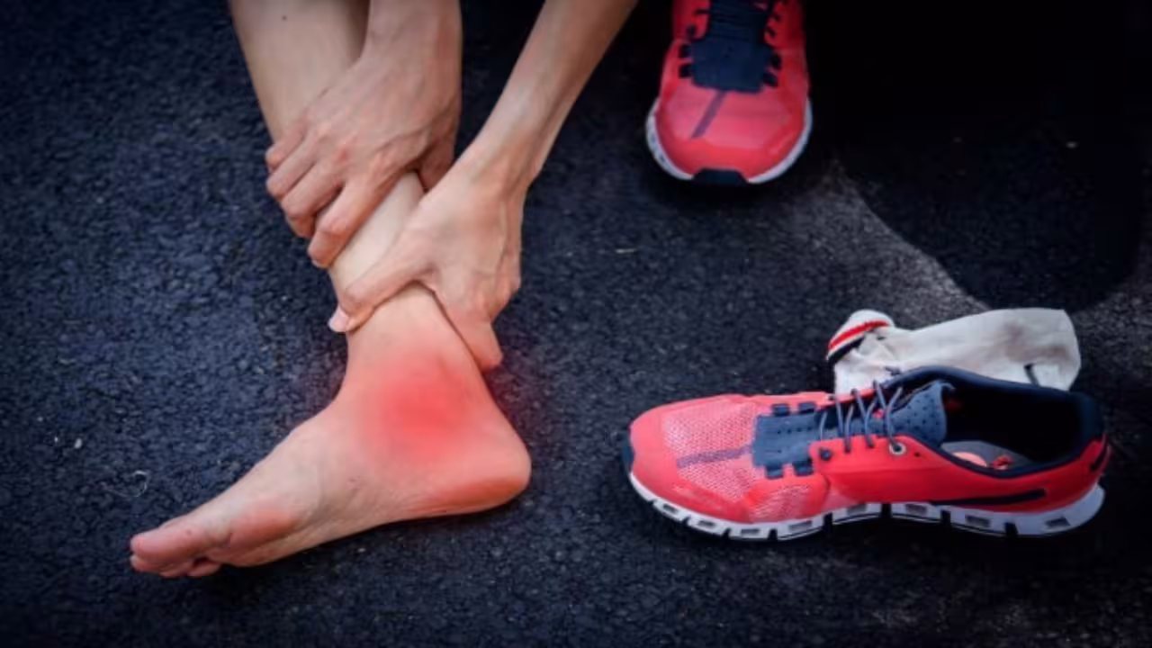 Leg Sprain