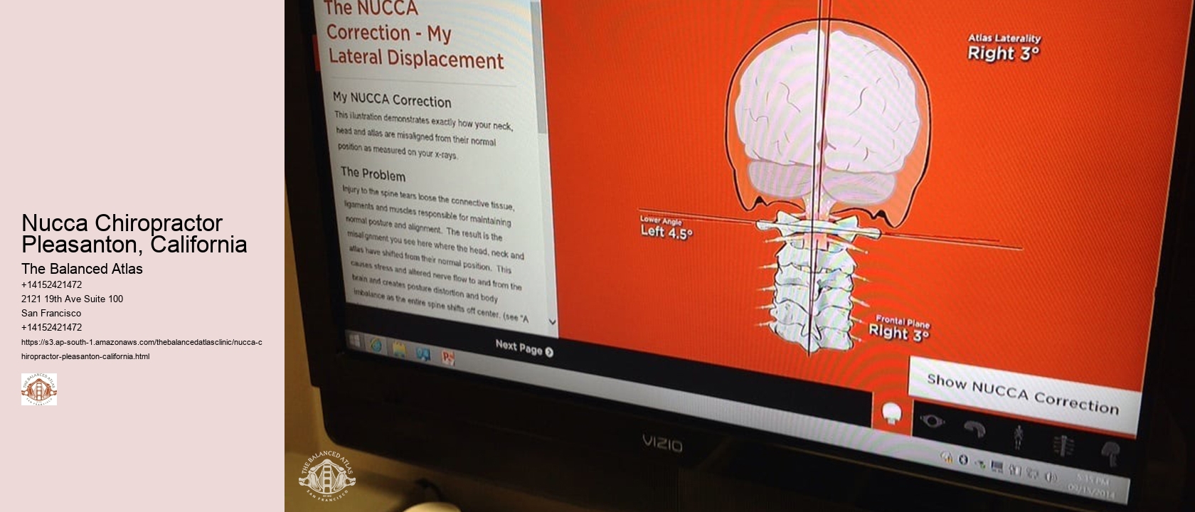 Nucca Chiropractor Pleasanton, California