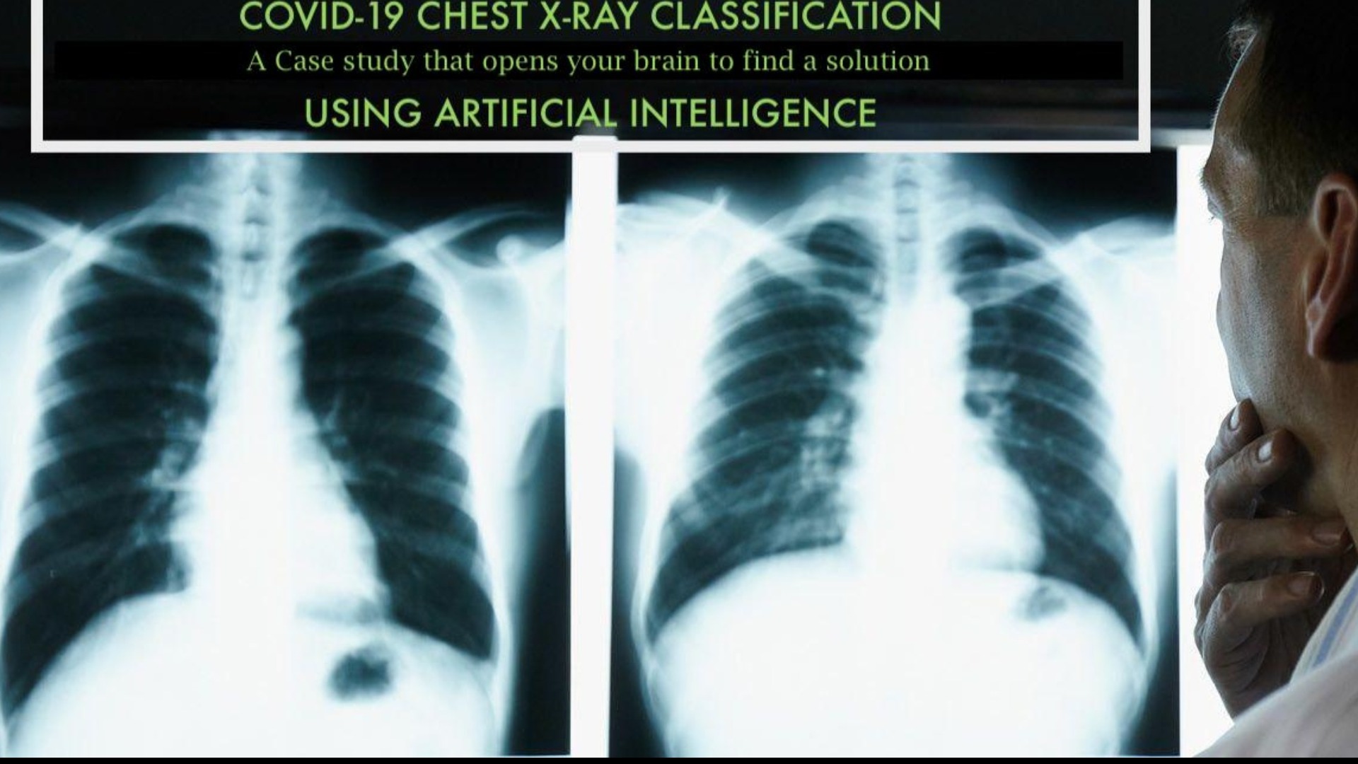 Covid 19 Chest X ray Data Analytics Case Study Tickets By DK AI LAB 