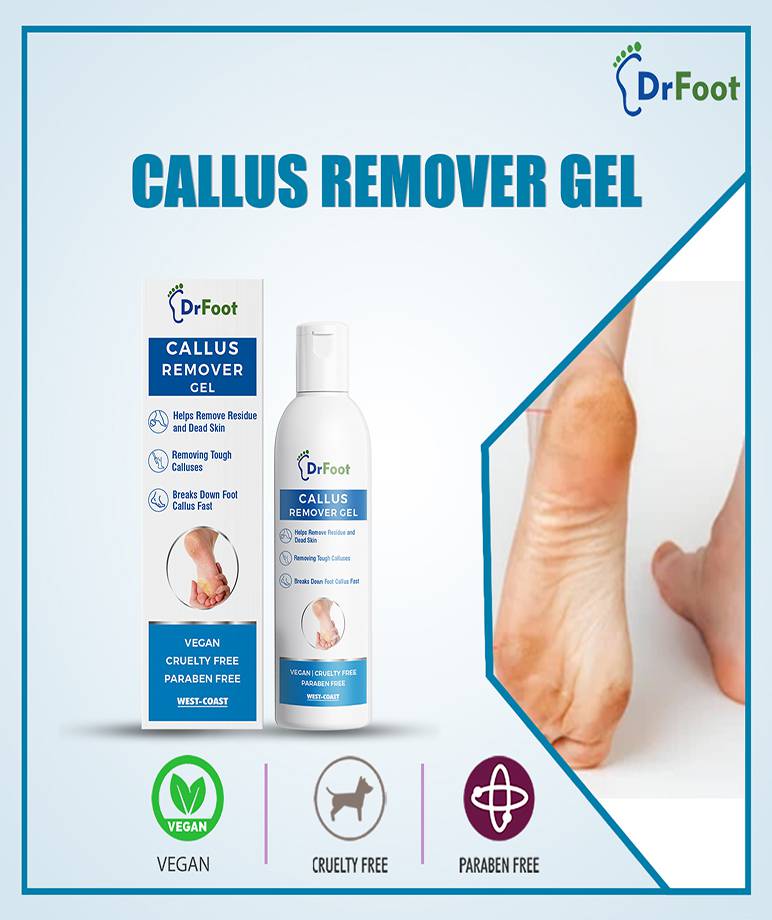 Callus Remover Gel Helps to remove Calluses Corns 100ml maccaron