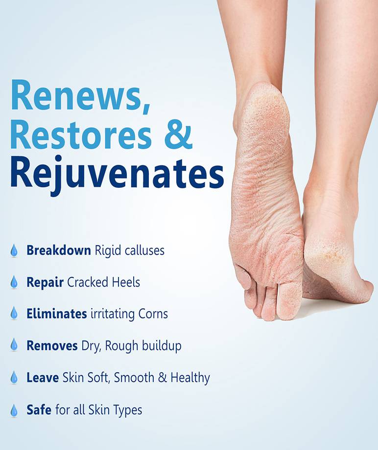 Callus Remover Gel Helps to remove Calluses Corns 100ml maccaron