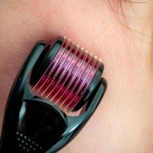 1MM Derma Roller: Rejuvenating Skin Promoting Hair Regrowth and Enhancing with Facial Scrubs & Polishes
