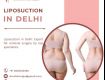 Liposuction in Delhi