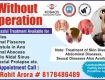 Without Operation Ayurveda successful Treatment for Piles, Fistula,fissure