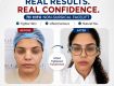 Plastic Surgery in Mumbai