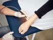 Class 4 Laser Therapy in Gurgaon