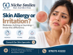 Acne Treatment in Borivali West, Mumbai at Niche Smiles